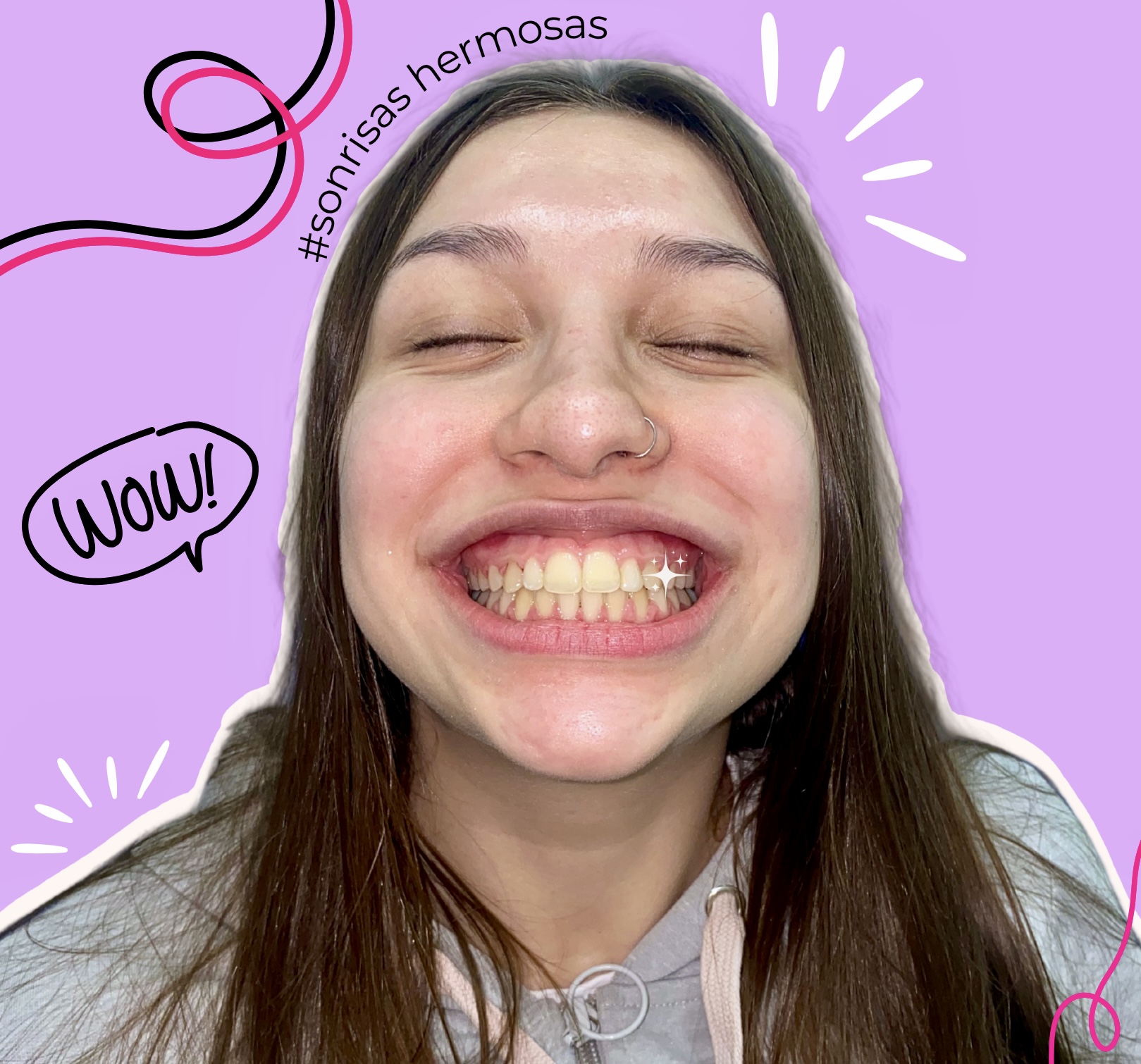 Transforma tu sonrisa